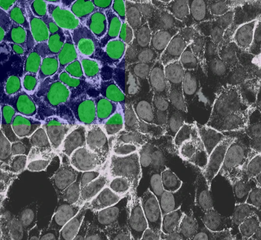 Microscopy image where cell nuclei are annotated in green in one region